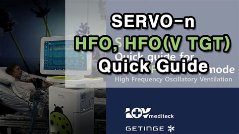 best hfo file|HFO Amplification .